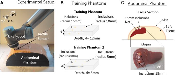 The robotic palpation setup: a UR5 arm with a tactile sensor over an abdominal phantom, two training phantoms with inclusions, and a cross-section of the abdominal phantom's silicone liver